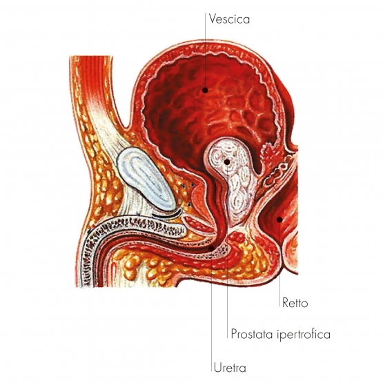 11 IMM1 Tavola disegno 1 copia